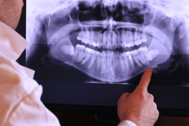 Best Mobile Emergency Dentist in Lake Of The Woods, IL